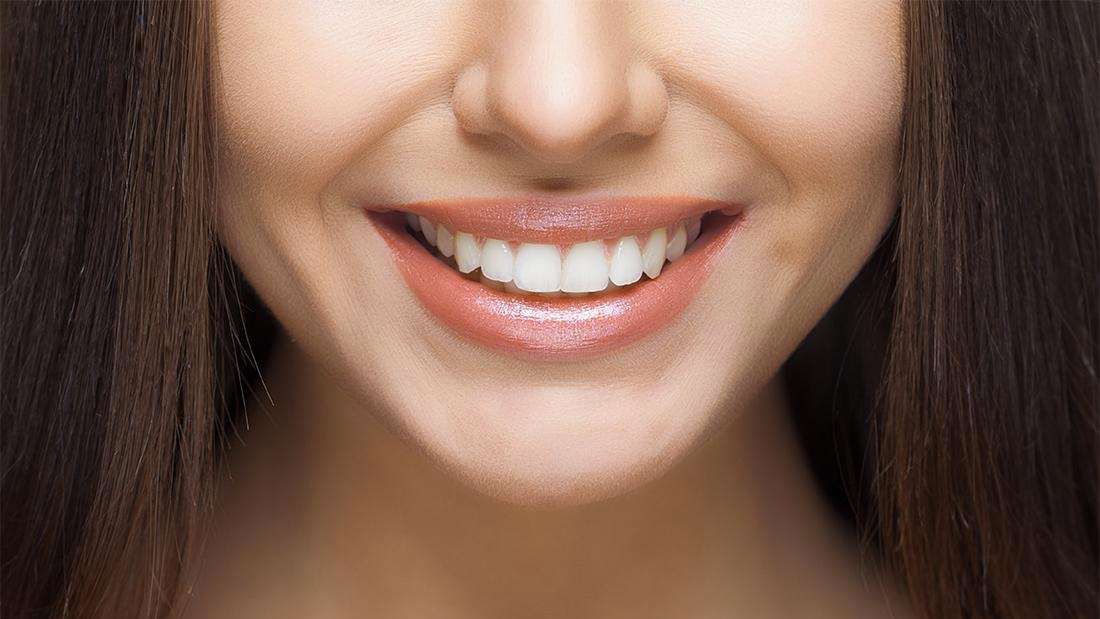 The Differences between Invisalign® and Traditional Braces Invisalign