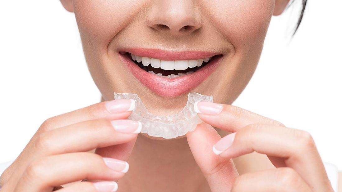 Why Do People in Mount Waverley Choose Invisalign® over Metal Braces